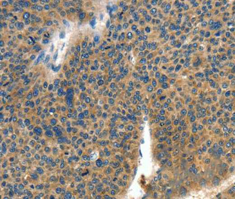 Anti-Human/Mouse COL4A2 Antibody