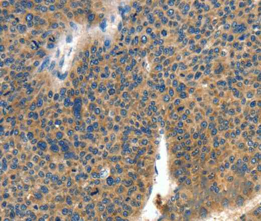 Anti-Human/Mouse COL4A2 Antibody