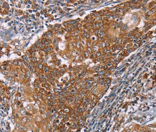 Anti-Human/Mouse/Rat PMPCB Antibody
