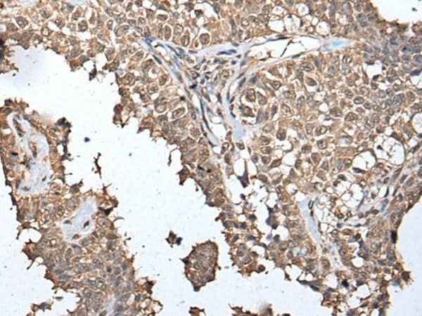 Anti-Human/Mouse METAP1D Antibody