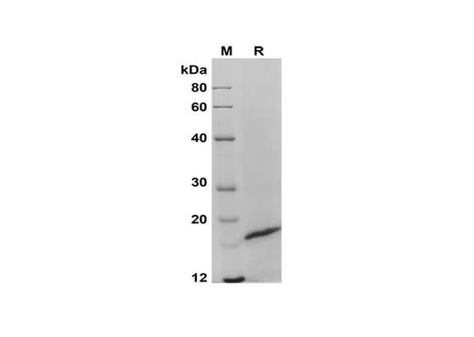 SDS-PAGE analysis of Human IL-20 proteins, 2 μg/lane of Recombinant Human IL-20 proteins was resolved with SDS-PAGE under reducing conditions, showing bands at 19 kDa.