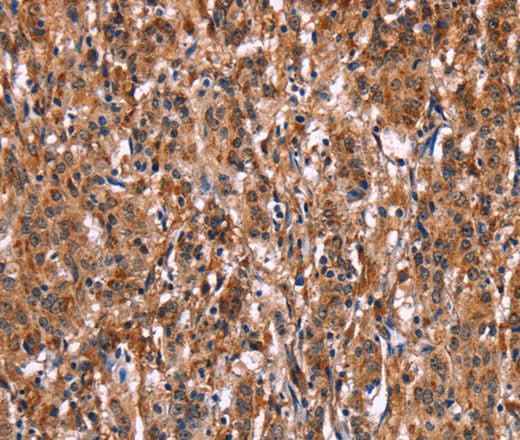 Anti-Human LILRB1 Antibody
