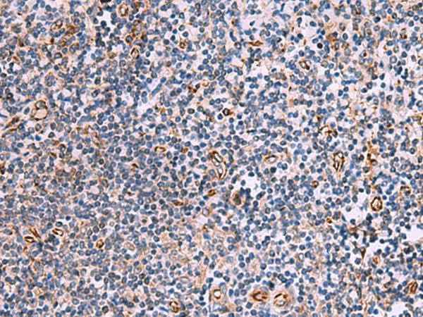 Anti-Human ITGA11 Antibody
