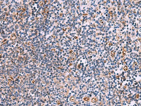 Immunohistochemistry of paraffin-embedded Human tonsil tissue using ITGA11 Polyclonal Antibody at dilution of 1:75(×200)