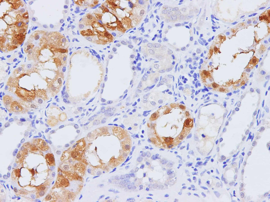 Anti-Human/Rat PCK1 Antibody - ABMIUM