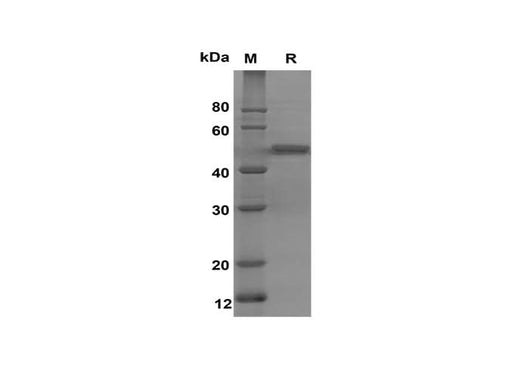 SDS-PAGE analysis of Human SNCα proteins, 2 μg/lane of Recombinant Human SNCα proteins was resolved with SDS-PAGE under reducing conditions , showing bands at 50 kDa.
