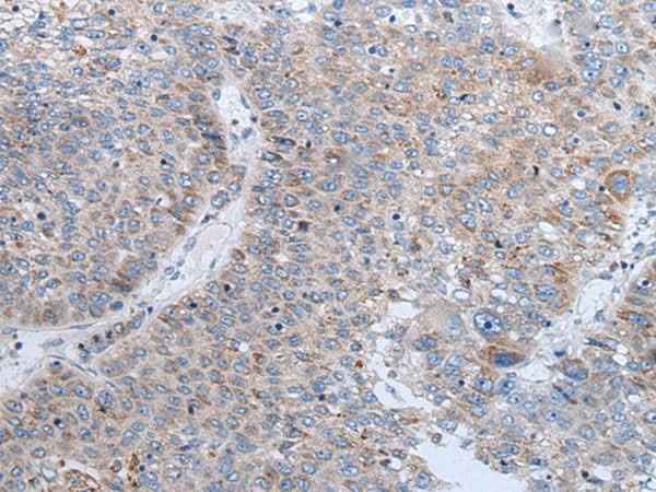 Anti-Human/Mouse/Rat ENPP2 Antibody