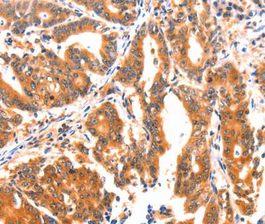 Anti-Human/Mouse AK5 Antibody