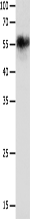 Anti-Human/Mouse/Rat CHRNA3 Antibody - ABMIUM