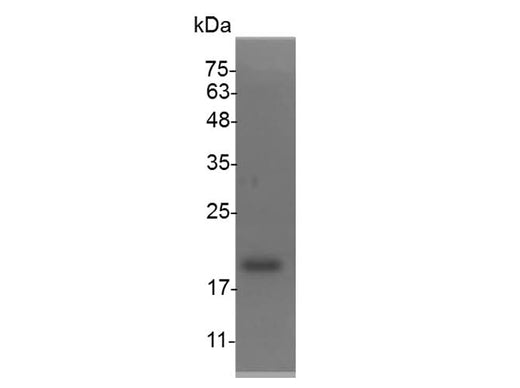 Recombinant Mouse IL-36 alpha protein(His Tag) - ABMIUM