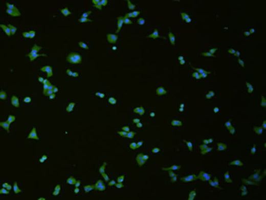 Immunofluorescence analysis of hela cell using SLC18A3 Polyclonal Antibody at dilution of 1:50