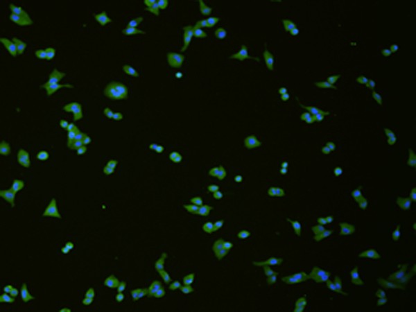 Immunofluorescence analysis of hela cell using SLC18A3 Polyclonal Antibody at dilution of 1:50