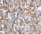 Anti-Human CD226 Antibody - ABMIUM