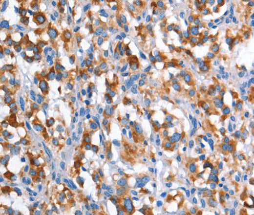 Anti-Human CD226 Antibody - ABMIUM