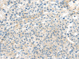 Anti-Human/Mouse TNFAIP8 Antibody - ABMIUM