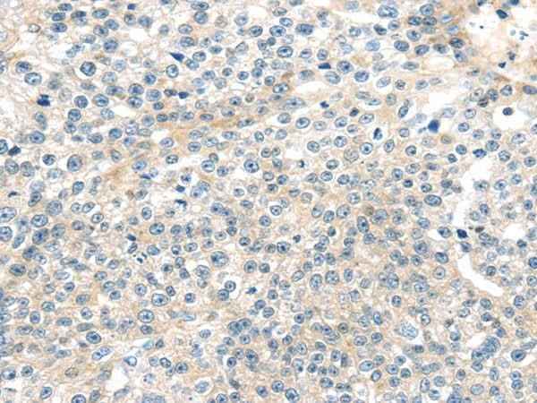 Anti-Human/Mouse TNFAIP8 Antibody
