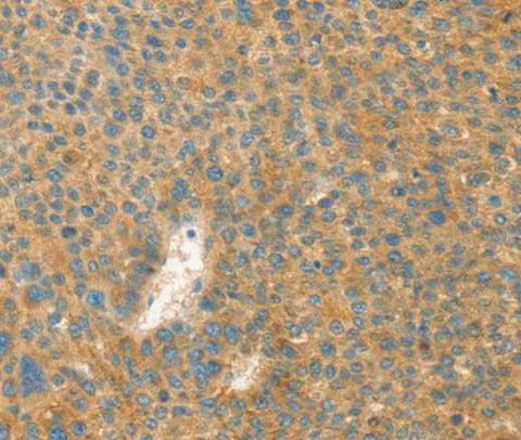 Anti-Human/Mouse/Rat AANAT Antibody