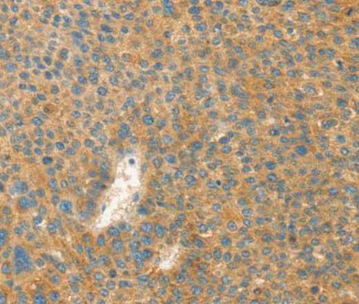 Anti-Human/Mouse/Rat AANAT Antibody