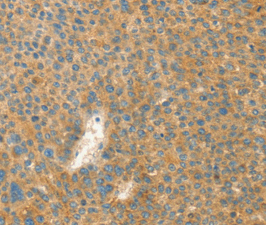 Anti-Human/Mouse/Rat AANAT Antibody - ABMIUM