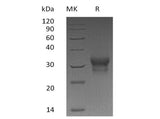 Recombinant Human IFN-λ1/IL-29 Protein (His Tag) - ABMIUM