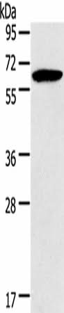 Anti-Human/Mouse HMGCS2 Antibody - ABMIUM