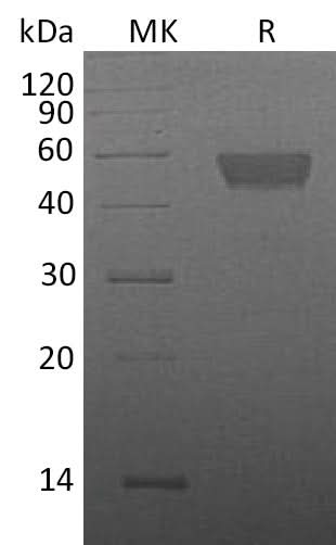 Recombinant Mouse TIGIT Protein (Fc Tag) - ABMIUM