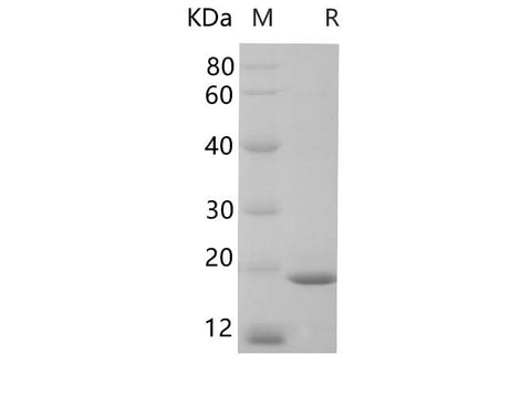 SDS-PAGE analysis of Human NGAL/LCN2 proteins, 2 μg/lane of Recombinant Human NGAL/LCN2 proteins was resolved with SDS-PAGE under reducing conditions, showing bands at 19 kDa.