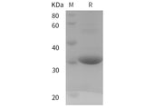 SDS-PAGE analysis of Human UCP3 proteins, 2 μg/lane of Recombinant Human UCP3 proteins was resolved with SDS-PAGE under reducing conditions, showing bands at 30 kDa.