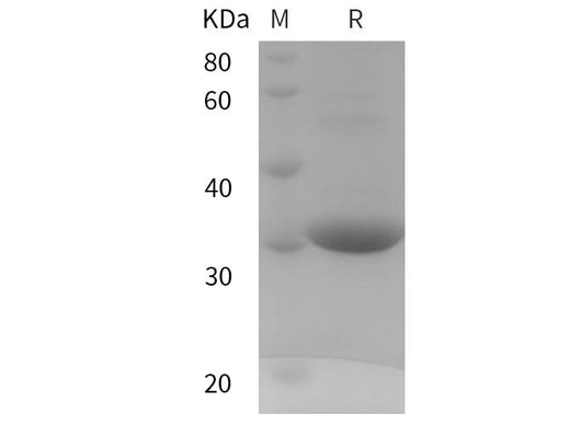 SDS-PAGE analysis of Human UCP3 proteins, 2 μg/lane of Recombinant Human UCP3 proteins was resolved with SDS-PAGE under reducing conditions, showing bands at 30 kDa.