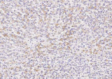 Anti-Human BST2 Antibody [A927] - ABMIUM
