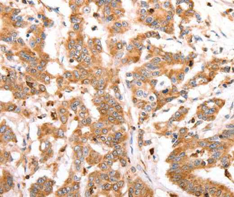 Anti-Human/Mouse/Rat CELSR2 Antibody