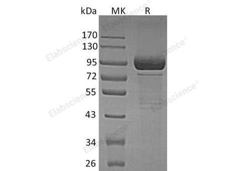 Recombinant Human β-Galactosidase/GLB1 Protein (His Tag) - ABMIUM