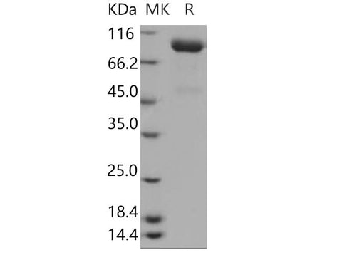 Recombinant Human SLITRK4 Protein (His Tag) - ABMIUM