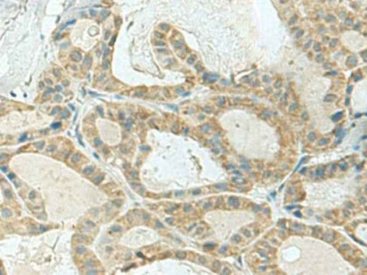 Anti-Human/Mouse KLC2 Antibody
