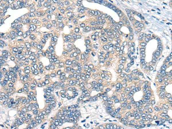 Anti-Human AURKA Antibody