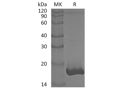 Recombinant Human GMFB Protein (His Tag) - ABMIUM