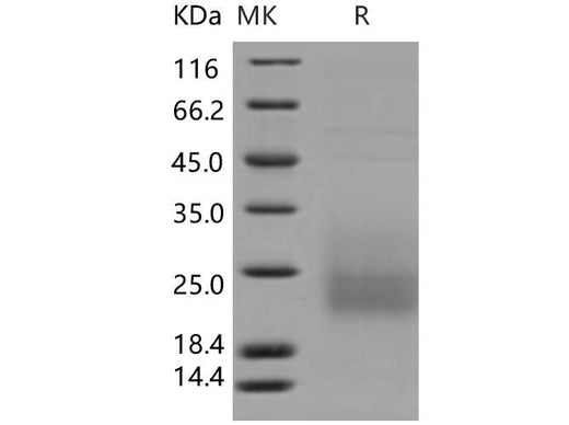 > 92 % as determined by reducing SDS-PAGE.