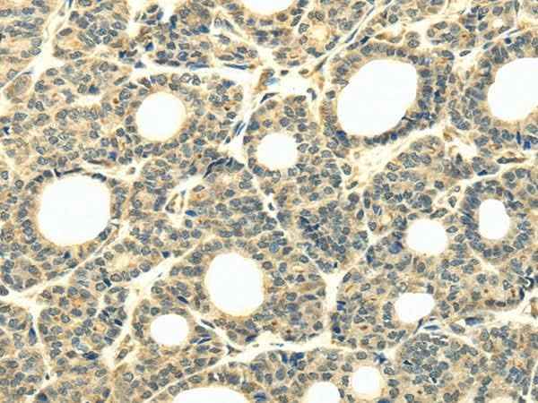 Anti-Human/Mouse WDR45B Antibody