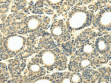 Anti-Human/Mouse WDR45B Antibody - ABMIUM