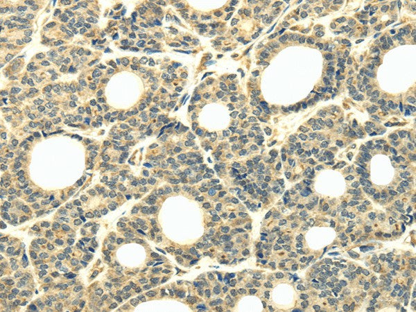 Anti-Human/Mouse WDR45B Antibody - ABMIUM