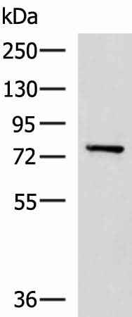 Anti-Human/Mouse/Rat CAPN5 Antibody