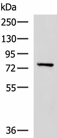 Western blot analysis of Mouse brain tissue lysate using CAPN5 Polyclonal Antibody at dilution of 1:550