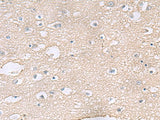 Immunohistochemistry of paraffin-embedded Human brain tissue using TAGLN3 Polyclonal Antibody at dilution of 1:60(×200)