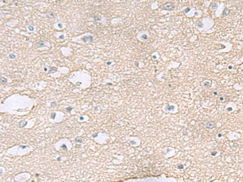 Immunohistochemistry of paraffin-embedded Human brain tissue using TAGLN3 Polyclonal Antibody at dilution of 1:60(×200)