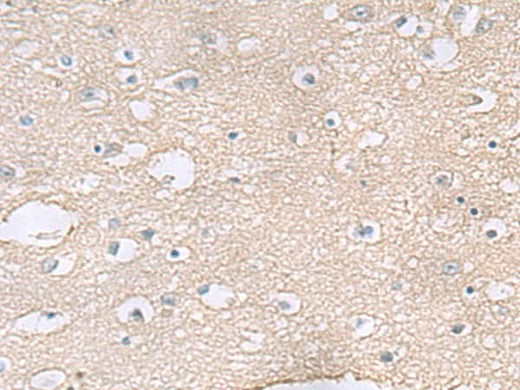 Immunohistochemistry of paraffin-embedded Human brain tissue using TAGLN3 Polyclonal Antibody at dilution of 1:60(×200)