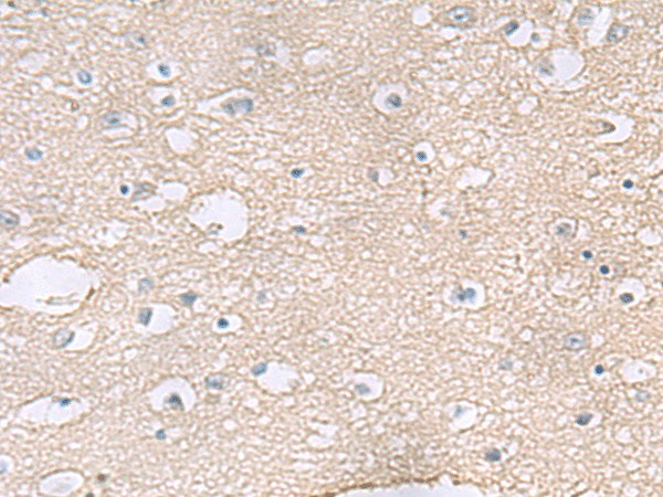 Immunohistochemistry of paraffin-embedded Human brain tissue using TAGLN3 Polyclonal Antibody at dilution of 1:60(×200)