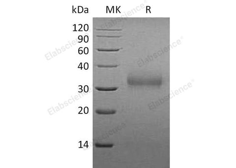 Recombinant Mouse Sclerostin/SOST Protein (His Tag) - ABMIUM