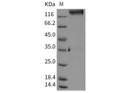> 92 % as determined by reducing SDS-PAGE.