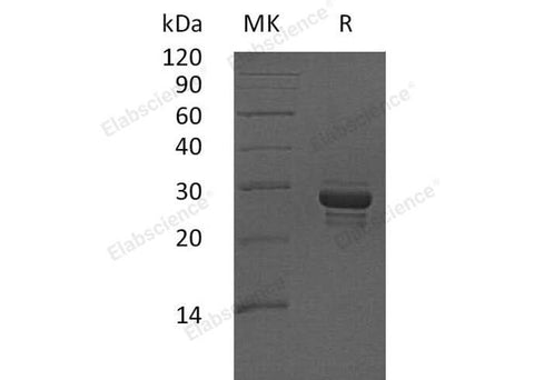 Recombinant Human CALCB Protein (aa 1-118, Fc Tag) - ABMIUM