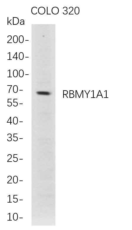Anti-Human RBMY1A1 Antibody [B723] - ABMIUM